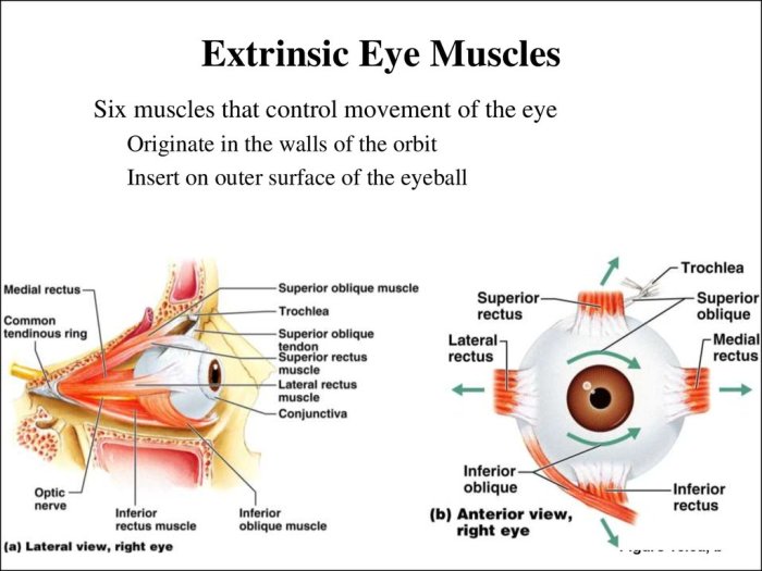 Label the extrinsic muscles of the eye